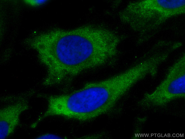 PAK4 Antibody in Immunocytochemistry (ICC/IF)