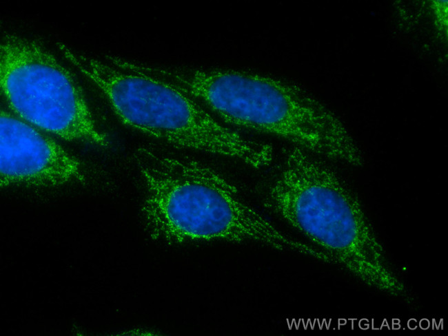 DLAT Antibody in Immunocytochemistry (ICC/IF)