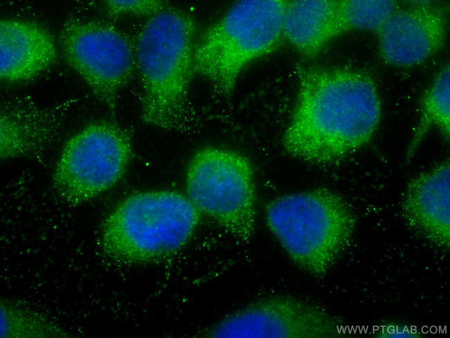 SNX18 Antibody in Immunocytochemistry (ICC/IF)
