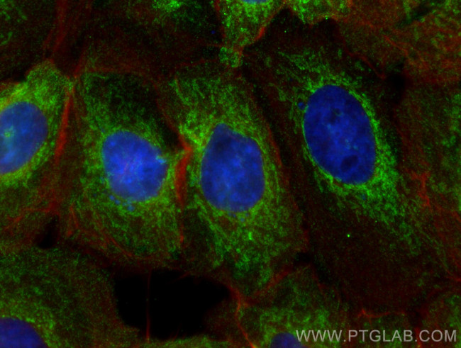 PNPT1 Antibody in Immunocytochemistry (ICC/IF)