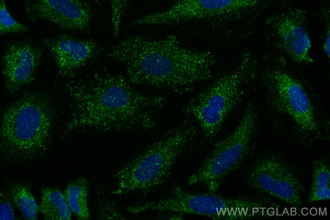 EXOSC10 Antibody in Immunocytochemistry (ICC/IF)