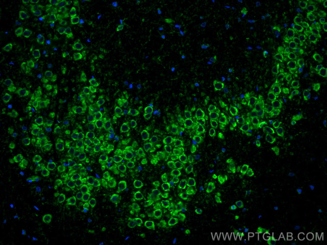 Ataxin 2 Antibody in Immunohistochemistry (PFA fixed) (IHC (PFA))
