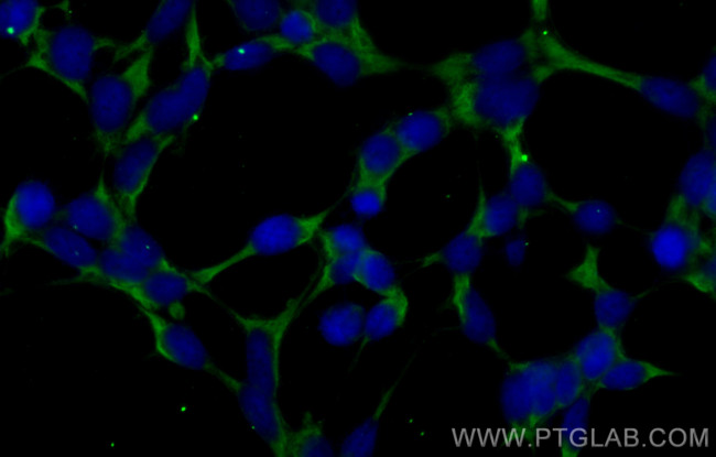 PBLD Antibody in Immunocytochemistry (ICC/IF)