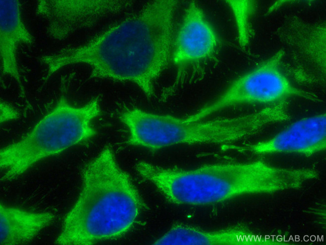SH3GLB2 Antibody in Immunocytochemistry (ICC/IF)