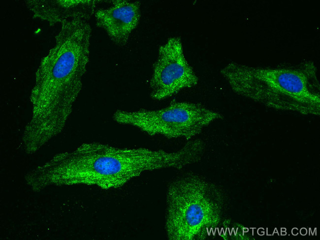 AZI2 Antibody in Immunocytochemistry (ICC/IF)
