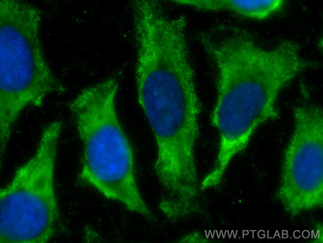 EPS8L2 Antibody in Immunocytochemistry (ICC/IF)