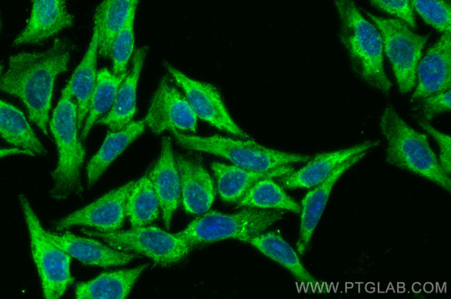 CCS Antibody in Immunocytochemistry (ICC/IF)