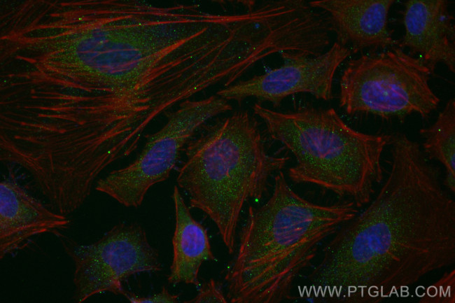 PCYT2 Antibody in Immunocytochemistry (ICC/IF)