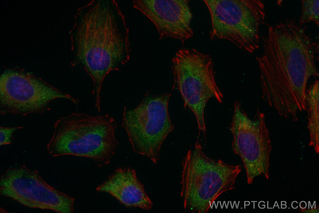 MCTS1 Antibody in Immunocytochemistry (ICC/IF)
