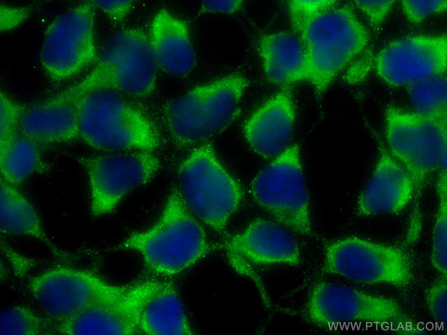 TSC2 Antibody in Immunocytochemistry (ICC/IF)