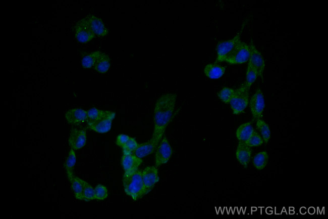 RAB33A Antibody in Immunocytochemistry (ICC/IF)