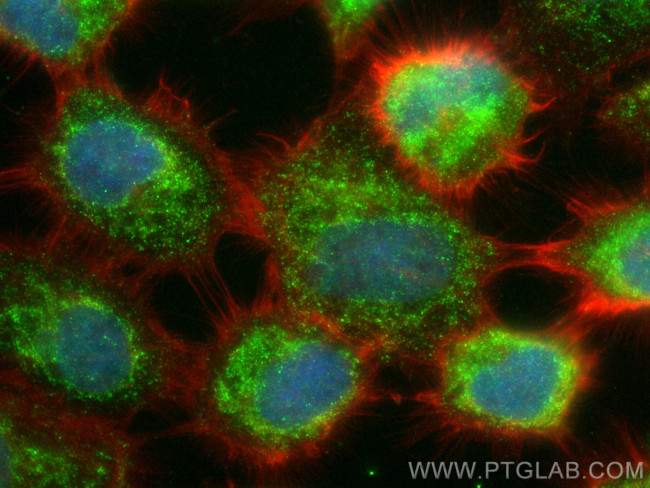 HDDC2 Antibody in Immunocytochemistry (ICC/IF)
