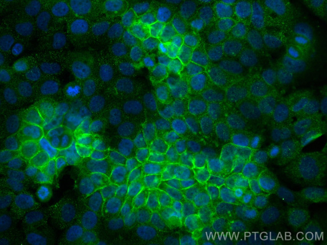Beta-2-Microglobulin Antibody in Immunocytochemistry (ICC/IF)