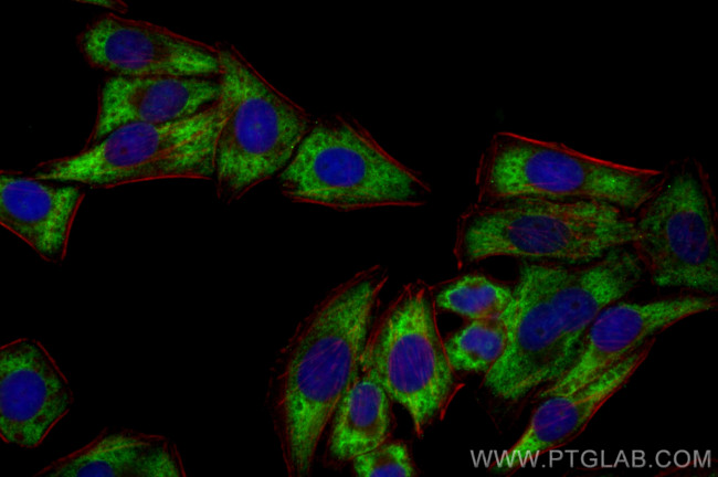 ALDOB Antibody in Immunocytochemistry (ICC/IF)
