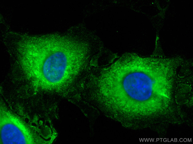 AMOTL2 Antibody in Immunocytochemistry (ICC/IF)