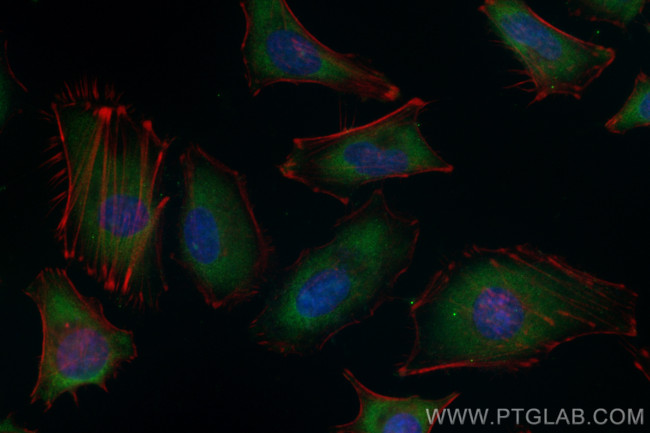 HIP1R Antibody in Immunocytochemistry (ICC/IF)