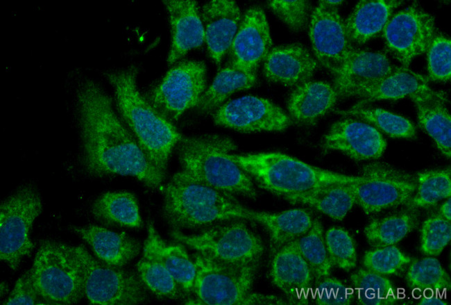 CHMP7 Antibody in Immunocytochemistry (ICC/IF)