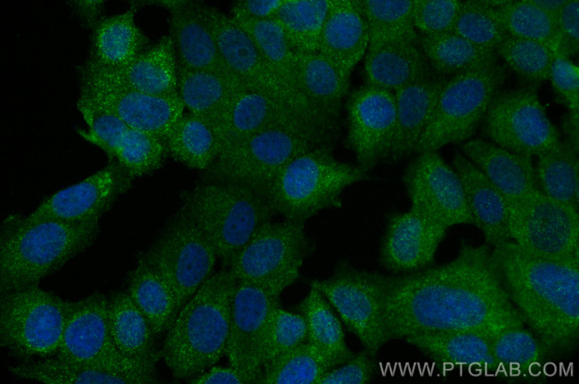 STUB1 Antibody in Immunocytochemistry (ICC/IF)