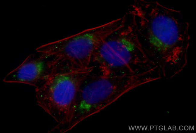 SYAP1 Antibody in Immunocytochemistry (ICC/IF)
