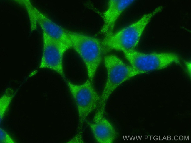 MPI Antibody in Immunocytochemistry (ICC/IF)