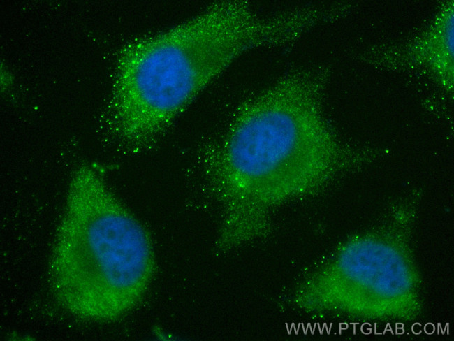 VPS4B Antibody in Immunocytochemistry (ICC/IF)