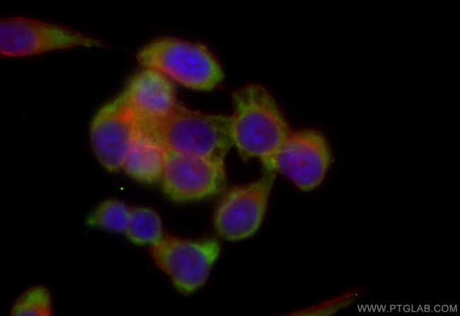 OTUD6B Antibody in Immunocytochemistry (ICC/IF)