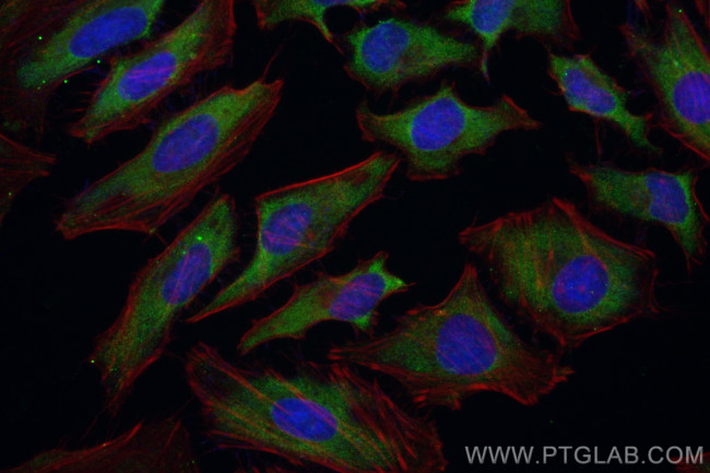 GIMAP7 Antibody in Immunocytochemistry (ICC/IF)