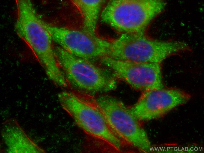 EIF2S1 Antibody in Immunocytochemistry (ICC/IF)