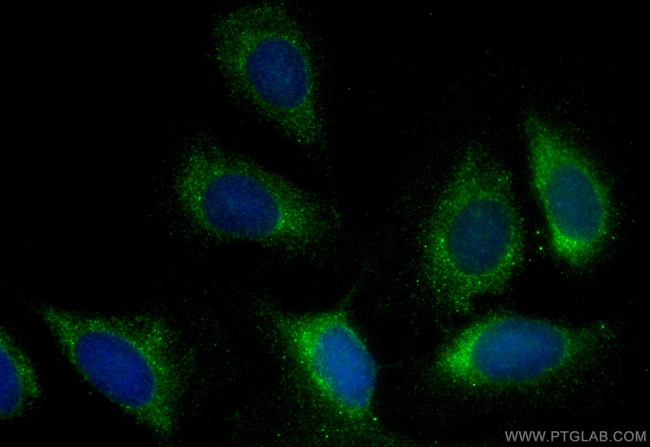 OTUB1 Antibody in Immunocytochemistry (ICC/IF)