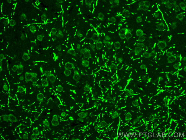 STK24 Antibody in Immunohistochemistry (Paraffin) (IHC (P))