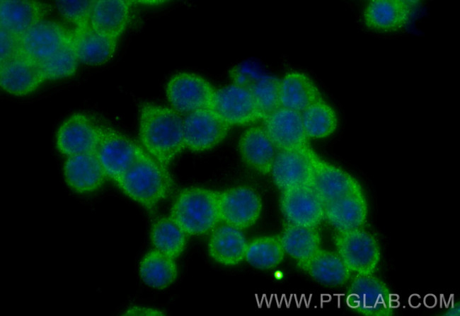 Spermidine synthase Antibody in Immunocytochemistry (ICC/IF)