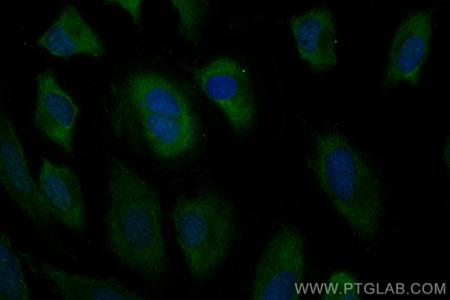 Angiopoietin 1 Antibody in Immunocytochemistry (ICC/IF)