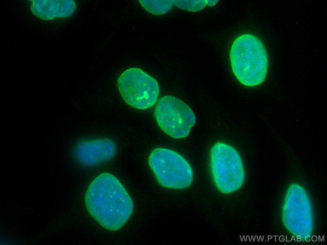 TDP-43 Antibody in Immunocytochemistry (ICC/IF)