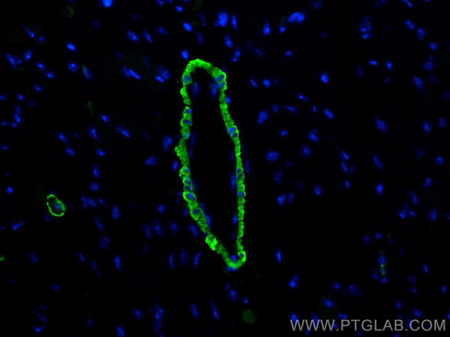 smooth muscle actin Antibody in Immunohistochemistry (PFA fixed) (IHC (PFA))