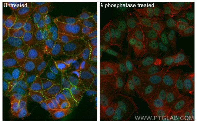 Phospho-Beta Catenin (Ser675) Antibody in Immunocytochemistry (ICC/IF)