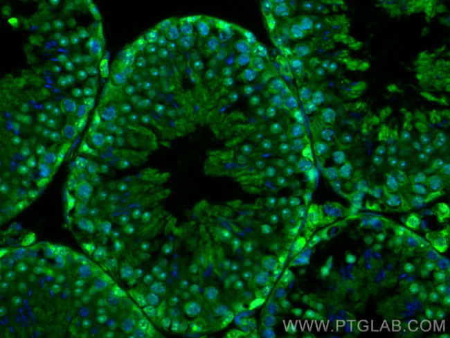 PARP1 Antibody in Immunohistochemistry (PFA fixed) (IHC (PFA))