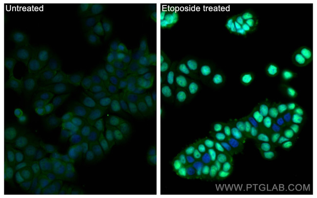 Phospho-P53 (Ser15) Antibody in Immunocytochemistry (ICC/IF)