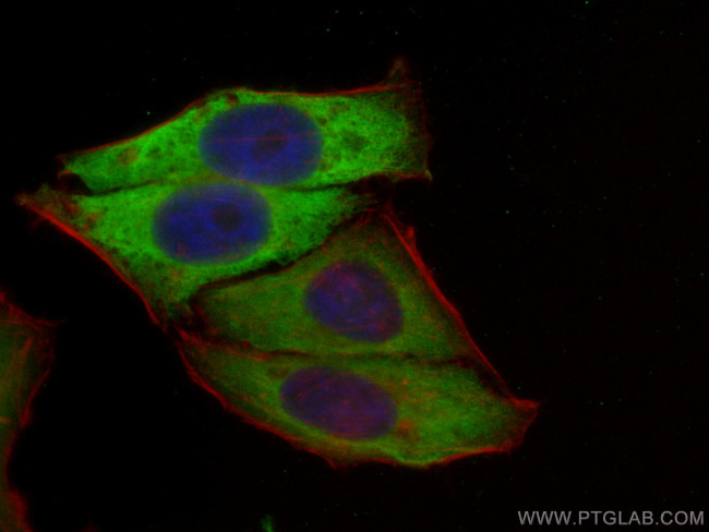 S6 Ribosomal protein Antibody in Immunocytochemistry (ICC/IF)