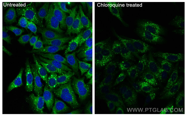 P62, SQSTM1 Antibody in Immunocytochemistry (ICC/IF)