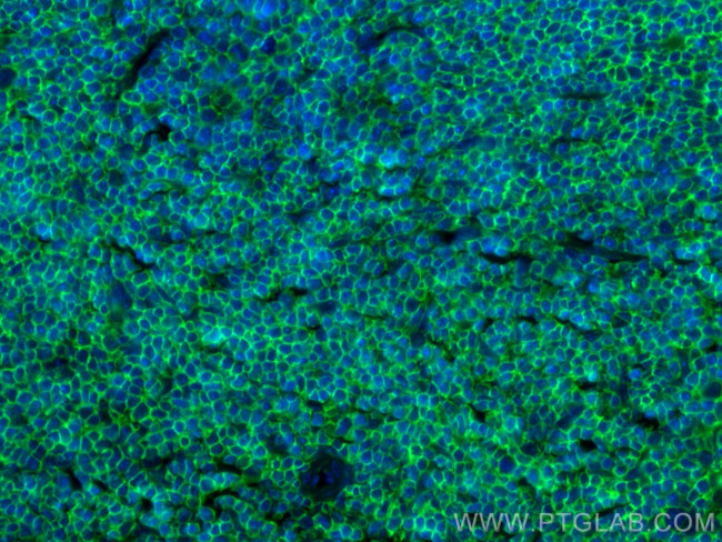 CD45 Antibody in Immunohistochemistry (PFA fixed) (IHC (PFA))