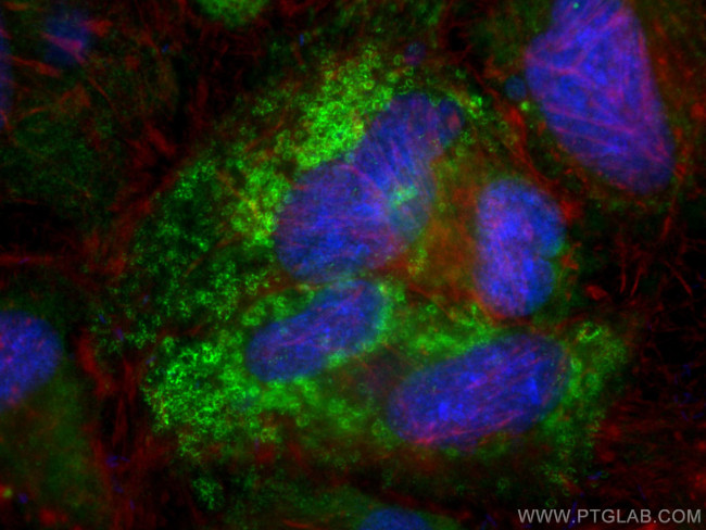 Perilipin-2 Antibody in Immunocytochemistry (ICC/IF)