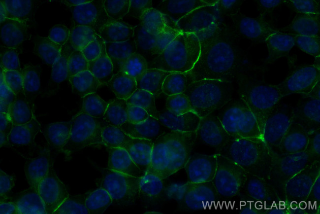 E-cadherin Antibody in Immunocytochemistry (ICC/IF)