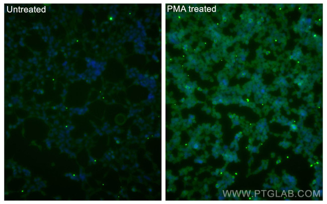 Phospho-mTOR (Ser2448) Antibody in Immunocytochemistry (ICC/IF)