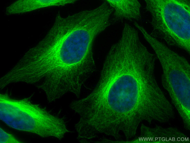 Beta Tubulin Antibody in Immunocytochemistry (ICC/IF)