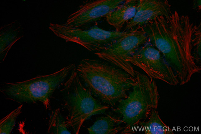 KEAP1 Antibody in Immunocytochemistry (ICC/IF)