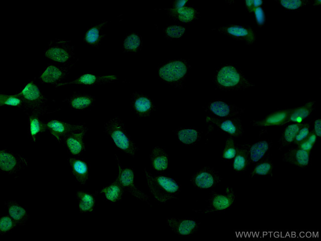 PAX8 Antibody in Immunocytochemistry (ICC/IF)