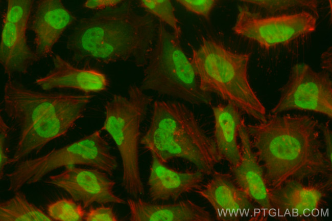 p38 MAPK Antibody in Immunocytochemistry (ICC/IF)