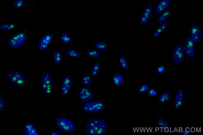 DDX21 Antibody in Immunocytochemistry (ICC/IF)
