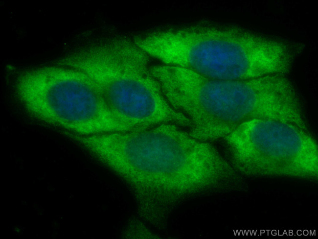 NF-kB p65 Antibody in Immunocytochemistry (ICC/IF)