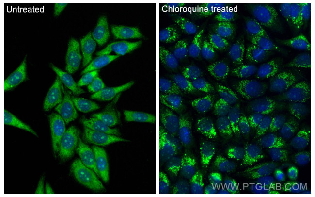 LC3 Antibody in Immunocytochemistry (ICC/IF)